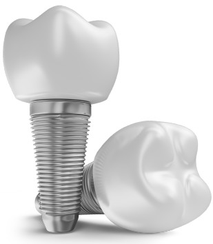 Implante dental
