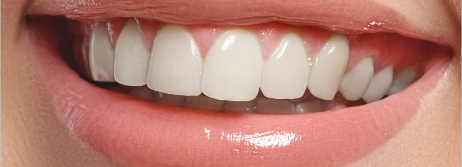 Sonrisa con prótesis dental