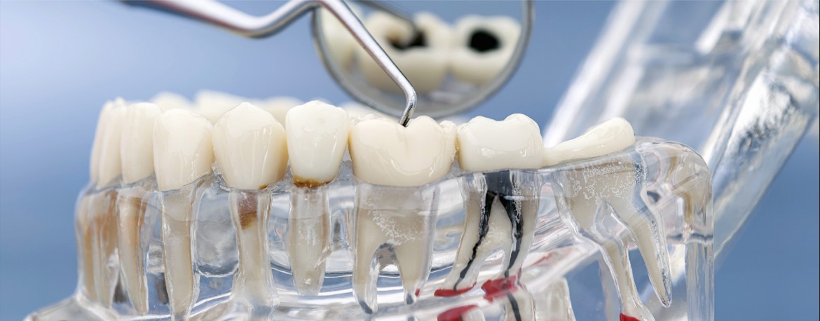 Revisión de una pieza dental